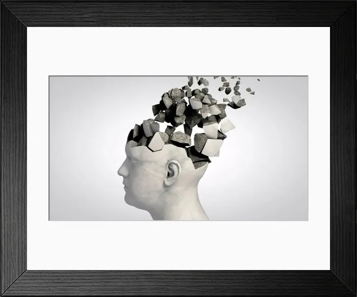 Framed Print : Dementia, conceptual illustration