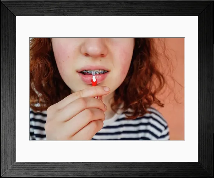 Framed Print : Girl cleaning dental braces with interdental brush Framed Print : Girl cleaning dental braces with interdental brush