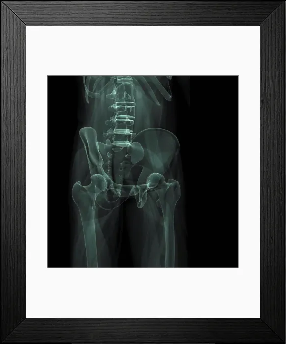 Framed Print : X-Ray image showing the pelvic region Framed Print : X-Ray image showing the pelvic region
