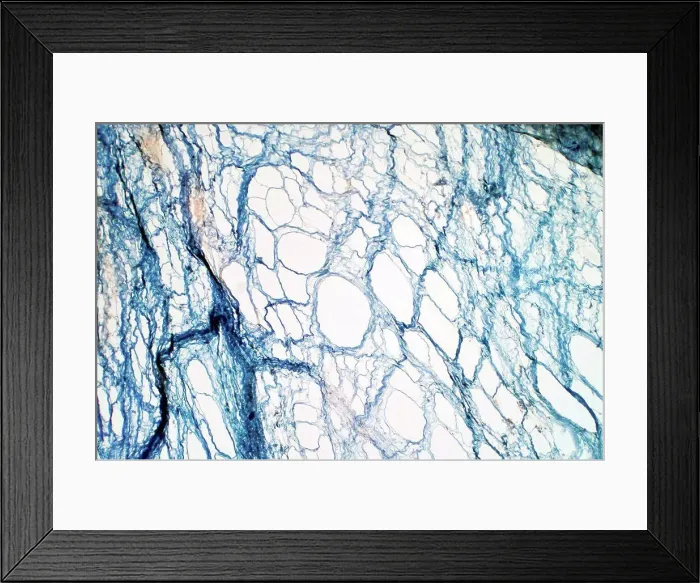 Framed Print : Areolar connective tissue, light micrograph