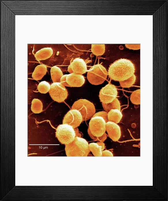 Framed Print : Scanning electron microscope image Framed Print : Scanning electron microscope image
