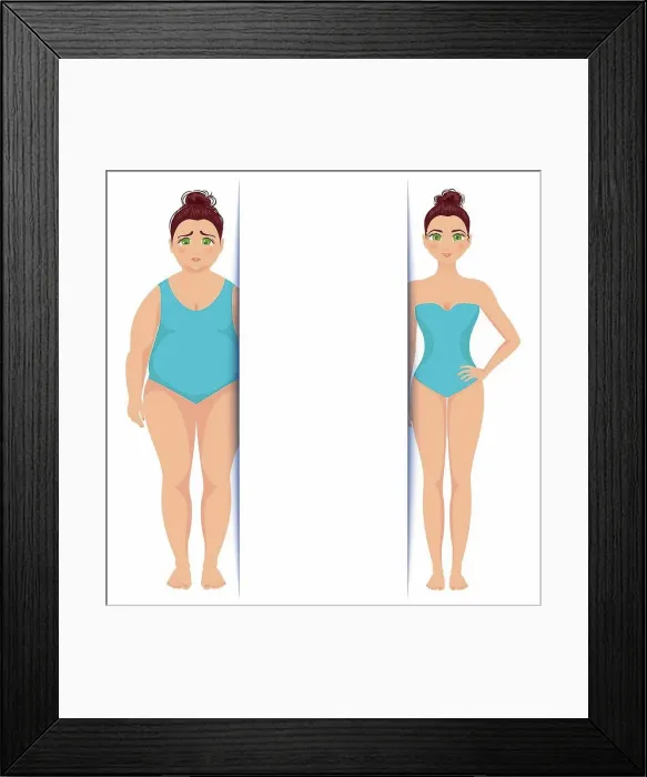 Framed Print : Female weight loss, illustration Framed Print : Female weight loss, illustration