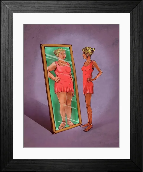 Framed Print : Illustration of eating disorder Framed Print : Illustration of eating disorder