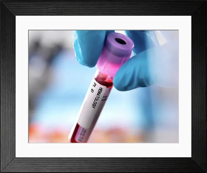 Framed Print : Cropped view of doctor holding vial of blood