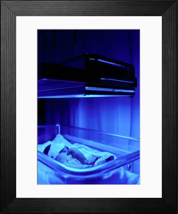 Framed Print : Blue light treatment for baby with jaundice Framed Print : Blue light treatment for baby with jaundice