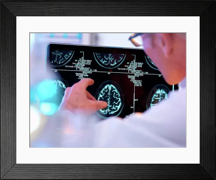 Framed Print : Radiologist assessing CT brain scan