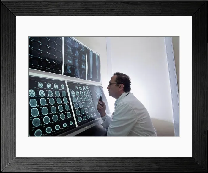 Framed Print : Doctor staring at scans of the brain on lightbox Framed Print : Doctor staring at scans of the brain on lightbox