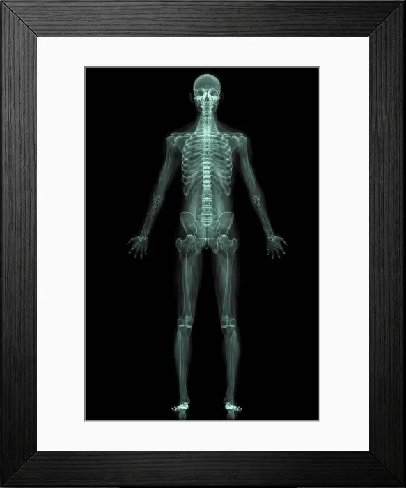 Framed Print : X-Ray image showing the entire human body Framed Print : X-Ray image showing the entire human body