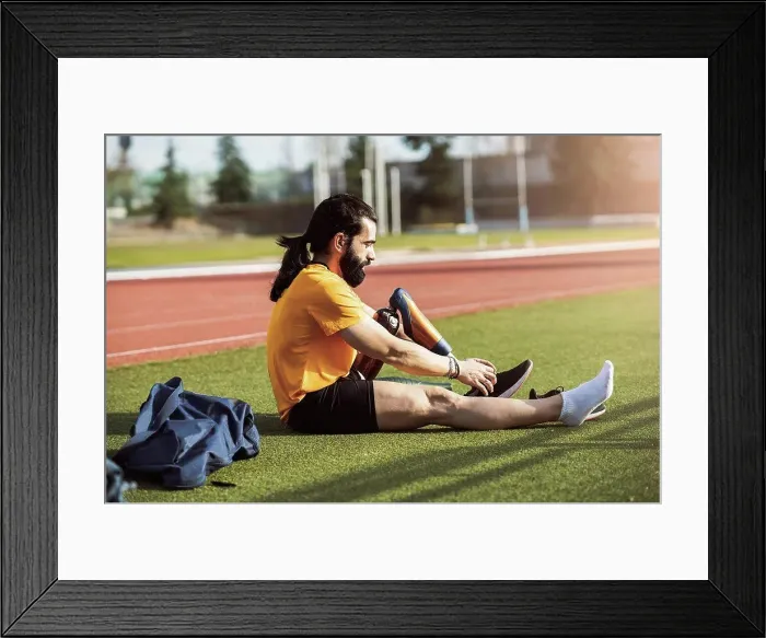 Framed Print : Bearded man wearing shoes on prosthetic leg Framed Print : Bearded man wearing shoes on prosthetic leg