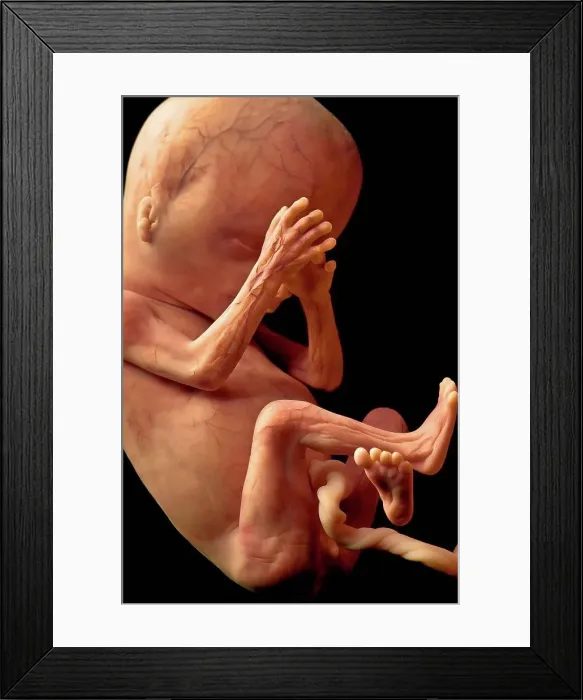Framed Print : Human Fetal Development at Twenty Weeks fetus Framed Print : Human Fetal Development at Twenty Weeks fetus