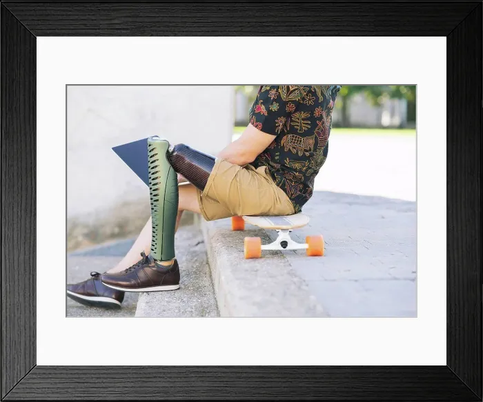 Framed Print : Man with prosthetic leg using laptop on steps Framed Print : Man with prosthetic leg using laptop on steps