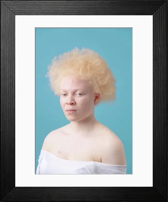 Framed Print : Studio portrait of albino woman Framed Print : Studio portrait of albino woman