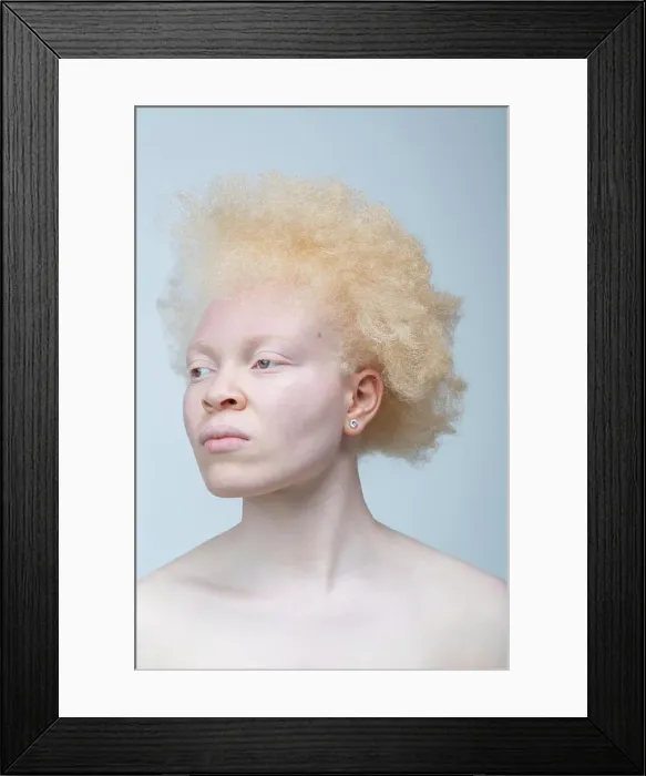 Framed Print : Studio portrait of albino woman Framed Print : Studio portrait of albino woman