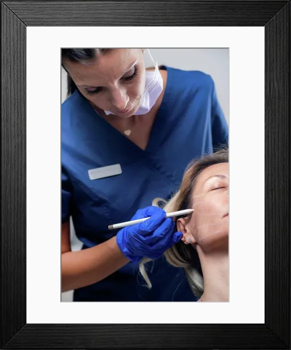 Framed Print : Mesotherapy thread face lift procedure Framed Print : Mesotherapy thread face lift procedure
