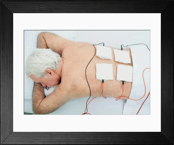 Framed Print : Electrotherapy physiotherapy treatment Framed Print : Electrotherapy physiotherapy treatment