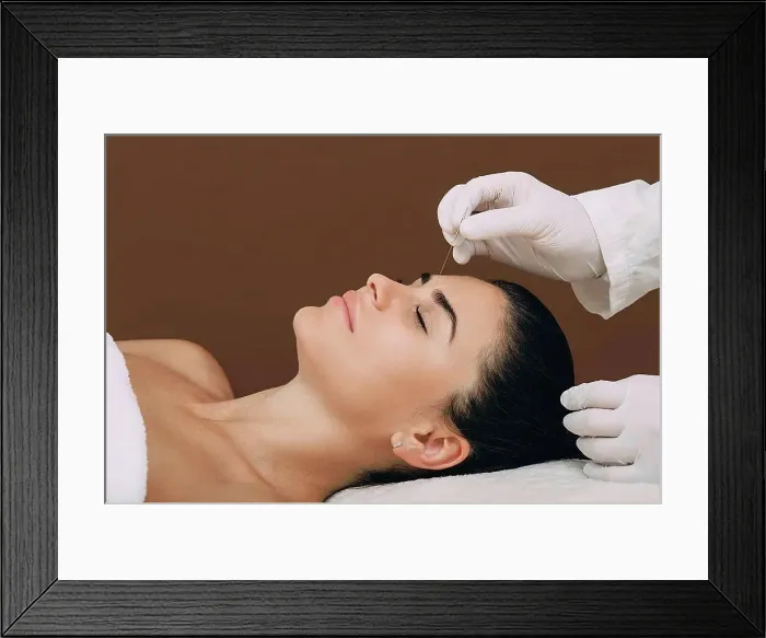Framed Print : Acupuncture Framed Print : Acupuncture