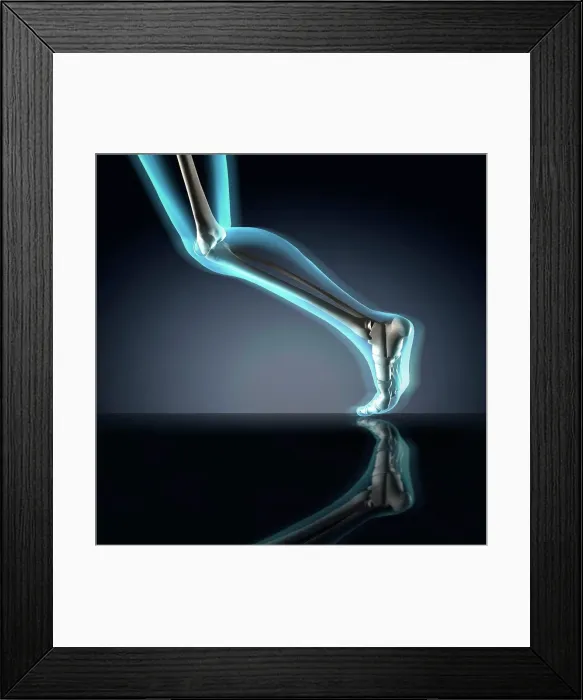 Framed Print : X-ray view of a human's leg in running position