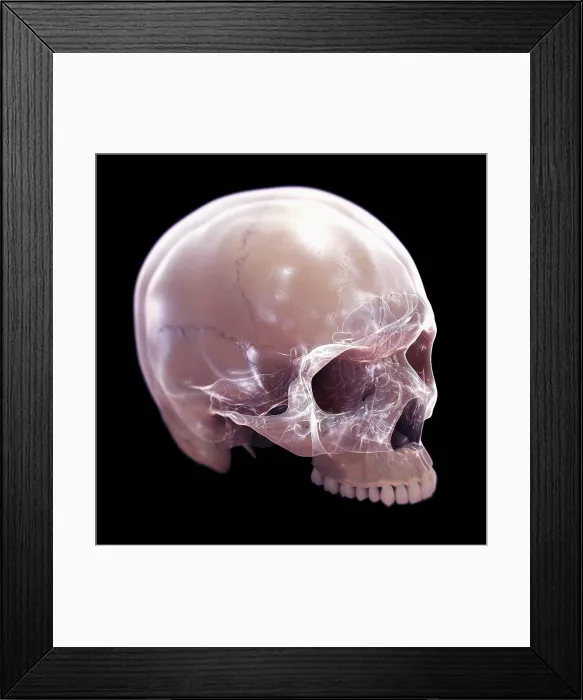 Framed Print : A human skull without the lower jaw. The inner structures of the skull are visible with an X-ray appearance Framed Print : A human skull without the lower jaw. The inner structures of the skull are visible with an X-ray appearance