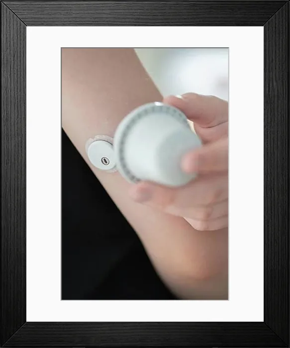 Framed Print : Child holding a setting aid for a glucose sensor Framed Print : Child holding a setting aid for a glucose sensor