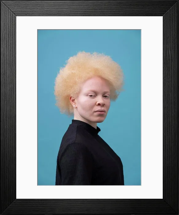 Framed Print : Studio portrait of albino woman Framed Print : Studio portrait of albino woman