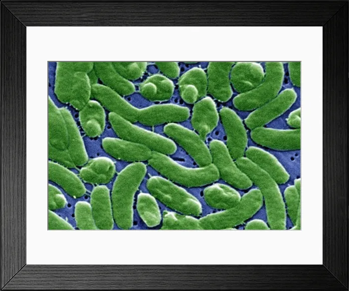 Framed Print : Vibrio vulnificus Bacteria Framed Print : Vibrio vulnificus Bacteria
