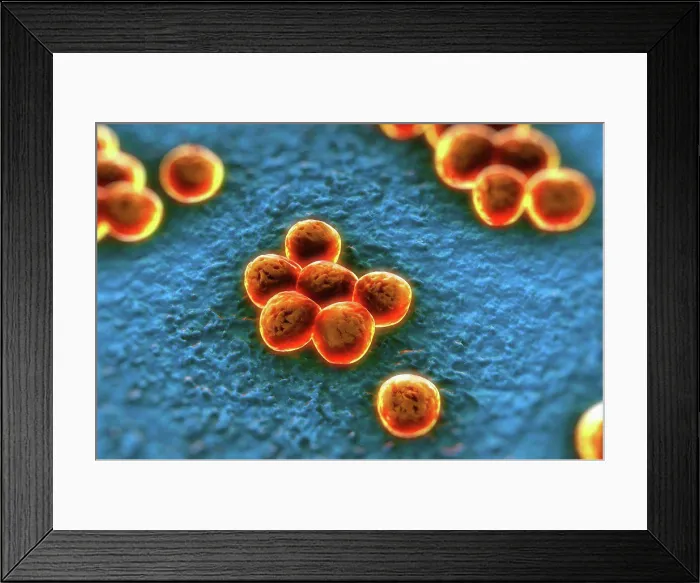 Framed Print : Clusters of superbug (MRSA) bacteria Framed Print : Clusters of superbug (MRSA) bacteria