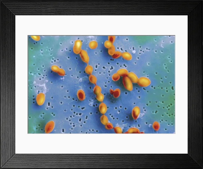 Framed Print : Pneumococcus bacteria (Pneumonia Cells) Framed Print : Pneumococcus bacteria (Pneumonia Cells)