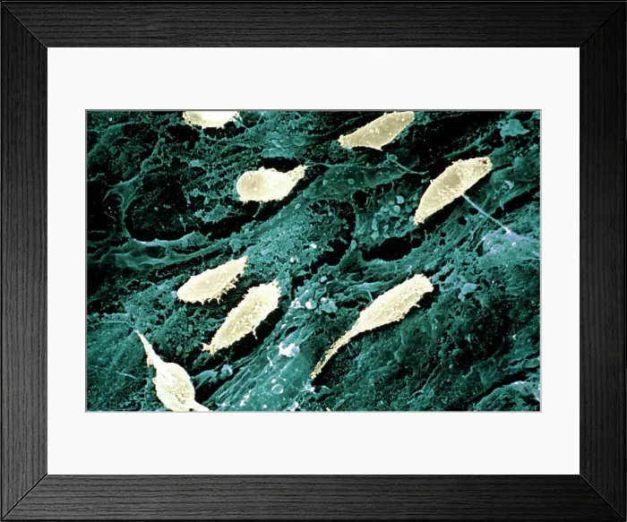 Framed Print : Collagen. Fibroplasts on external surface of intestine ESM (Electron Scanning Microscope)