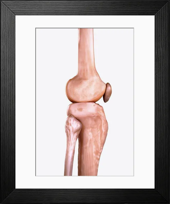 Framed Print : Right Knee Bones Framed Print : Right Knee Bones