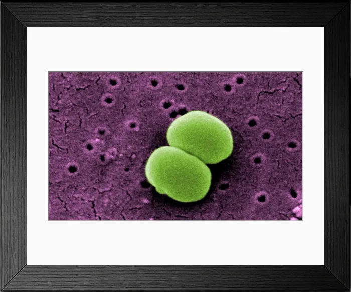 Framed Print : Scanning electron microscopic image of Staphylococcus epidermidis Framed Print : Scanning electron microscopic image of Staphylococcus epidermidis