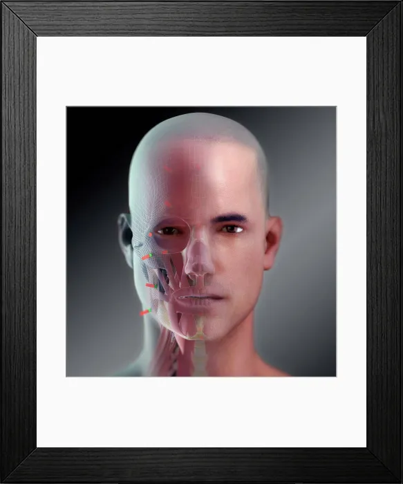 Framed Print : Facial Reconstruction