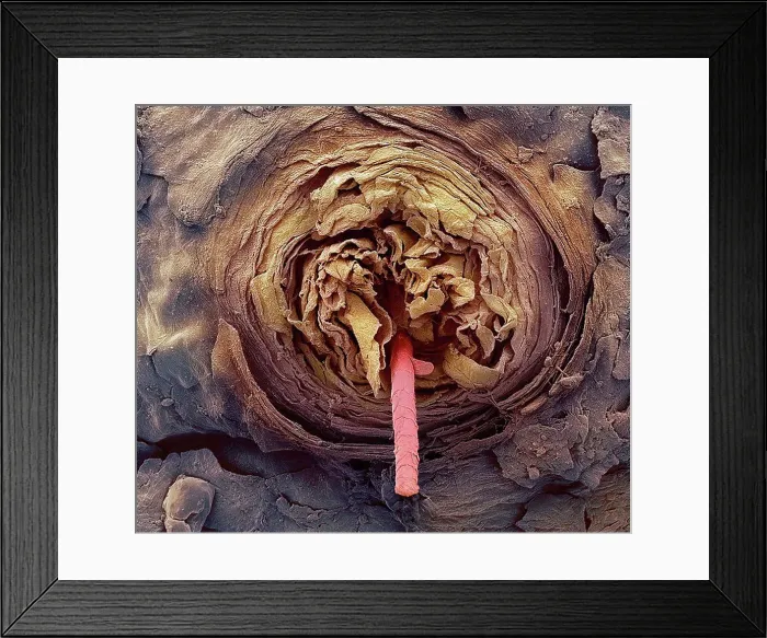 Framed Print : Eyelash follicle, coloured scanning electron micrograph SEM. Magnification: x400 when printed at 10 centimetres wide Framed Print : Eyelash follicle, coloured scanning electron micrograph SEM. Magnification: x400 when printed at 10 centimetres wide