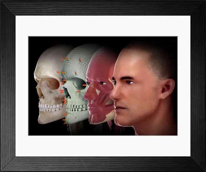 Framed Print : Facial Reconstruction