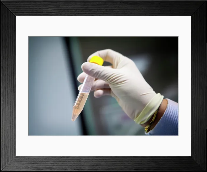 Framed Print : Reportage in a laboratory which develops therapeutic vaccinations to treat small-cell lung cancer Framed Print : Reportage in a laboratory which develops therapeutic vaccinations to treat small-cell lung cancer