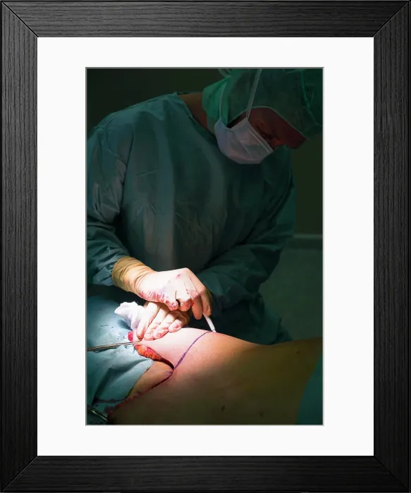 Framed Print : Reportage in the Saint François plastic surgery clinic in Nice Framed Print : Reportage in the Saint François plastic surgery clinic in Nice