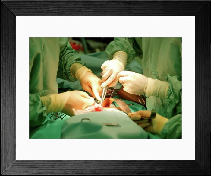 Framed Print : Surgeons performing abdominal operation. Close-up. UK Framed Print : Surgeons performing abdominal operation. Close-up. UK