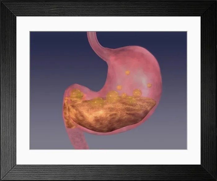Framed Print : Stomach Framed Print : Stomach