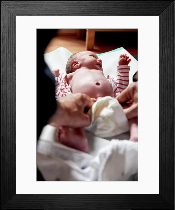 Framed Print : Reportage on a midwife in Lyon, France. Examining a 2-week old babys hips and pelvis Framed Print : Reportage on a midwife in Lyon, France. Examining a 2-week old babys hips and pelvis