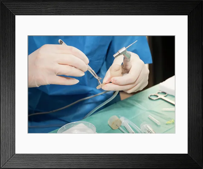 Framed Print : Reportage in the Mozart plastic surgery clinic in Nice Framed Print : Reportage in the Mozart plastic surgery clinic in Nice