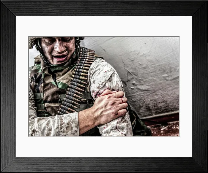 Framed Print : Soldier clamping his gunshot wound with healthy hand to try and stop bleeding Framed Print : Soldier clamping his gunshot wound with healthy hand to try and stop bleeding