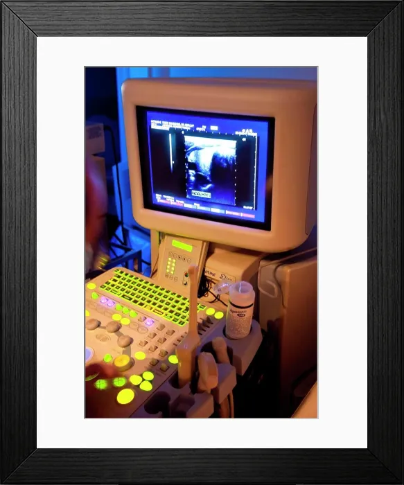 Framed Print : Thyroid ultrasound Framed Print : Thyroid ultrasound