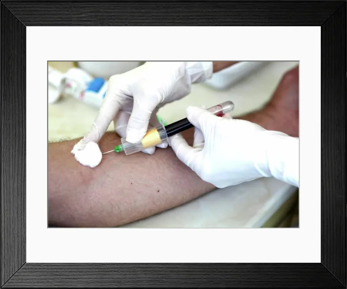 Framed Print : Blood Test Blood Test Copyright: xZoonar.com / VladimirxNenovx 3339924 Framed Print : Blood Test Blood Test Copyright: xZoonar.com / VladimirxNenovx 3339924