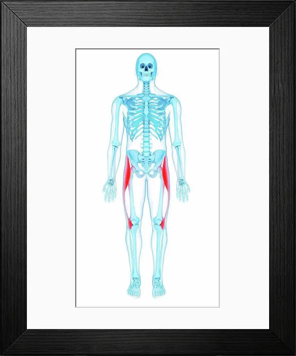 Framed Print : Illustration of the tensor fascia lata muscles Framed Print : Illustration of the tensor fascia lata muscles