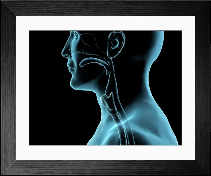 Framed Print : Sore throat, side x-ray, Hank Grebe, (b.20th C. / American), Computer graphics Framed Print : Sore throat, side x-ray, Hank Grebe, (b.20th C. / American), Computer graphics