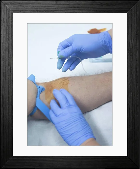 Framed Print : Taking blood sample Framed Print : Taking blood sample