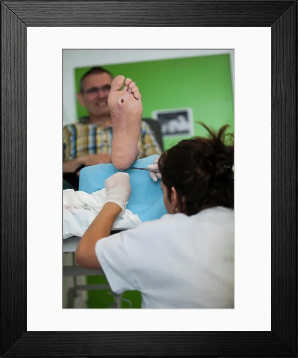 Framed Print : Reportage on diabetic feet consultations in a hospital in Savoie Framed Print : Reportage on diabetic feet consultations in a hospital in Savoie