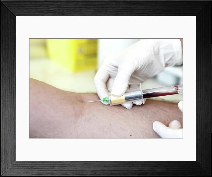 Framed Print : A blood test is a laboratory analysis performed on a blood sample that is usually extracted from a vein in the arm Framed Print : A blood test is a laboratory analysis performed on a blood sample that is usually extracted from a vein in the arm