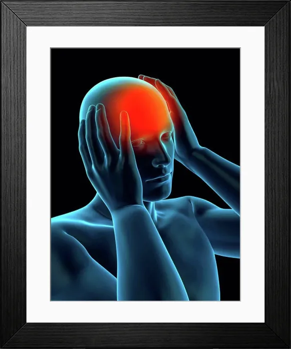 Framed Print : Person with headache, illustration