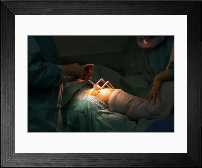 Framed Print : Reportage in the orthopedic surgery service in Saint George Clinic Framed Print : Reportage in the orthopedic surgery service in Saint George Clinic