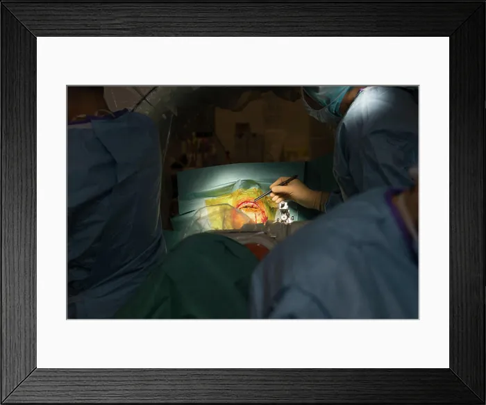 Framed Print : Reportage in the stereotactic neurosurgery operating theatre in Pasteur 2 Hospital